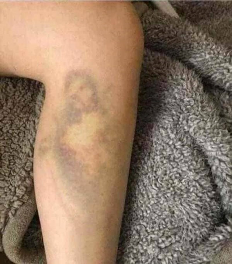 Masnica izgleda kao Isus