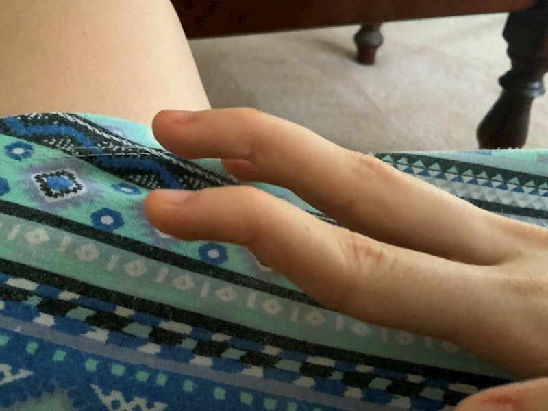 8. Pomicanje samo gornjeg članka prstiju