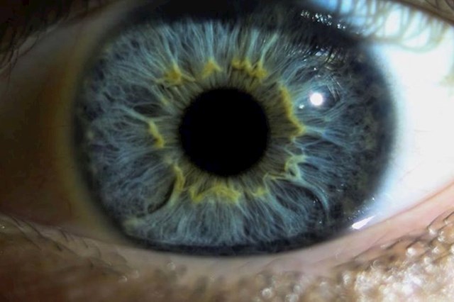 Oko žute boje