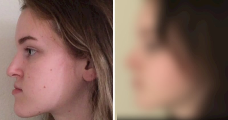 15 ljudi koji su obavili plastične operacije i sad su potpuno nove osobe