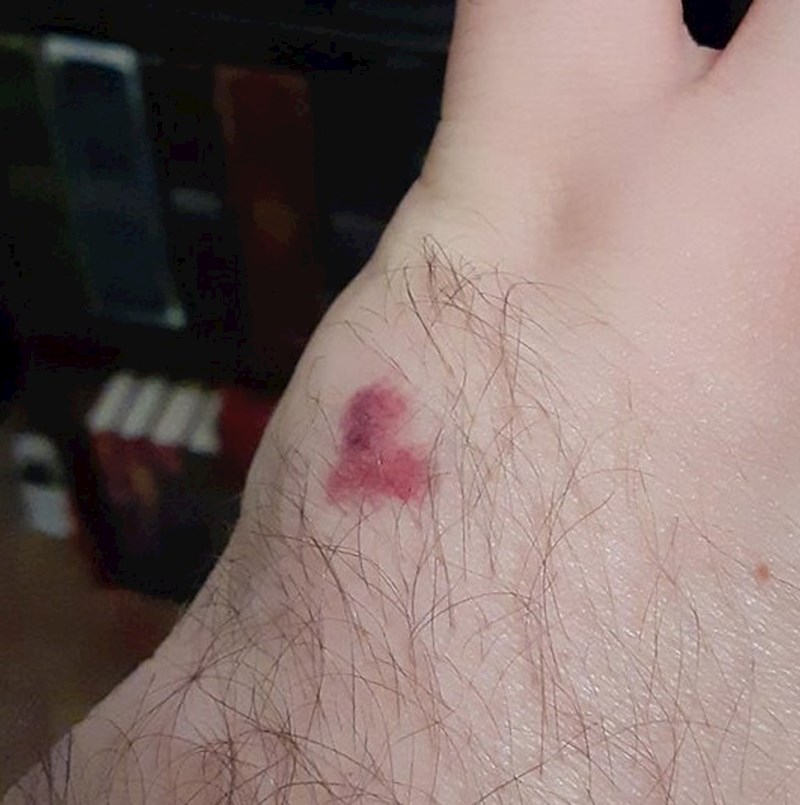 Imam madež u obliku srca