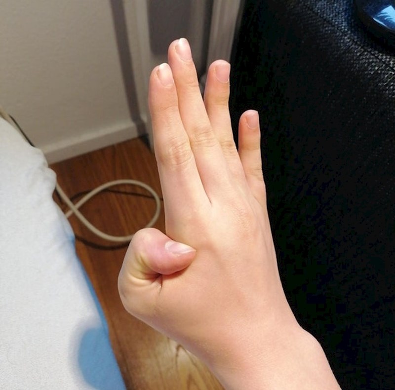 Mogu savinuti palac u potpuno suprotnom smjeru