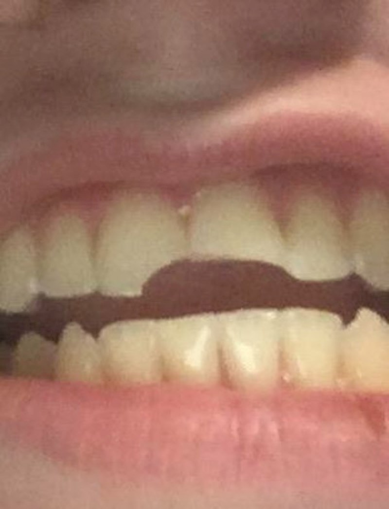 Onesvijestio sam se u kupaoni i udario glavom od ormarić