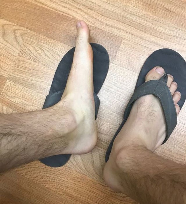 Imam potpuno ravna stopala