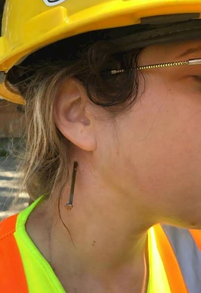 Dobila sam čavao u vrat! ČAVAO U VRAT!!