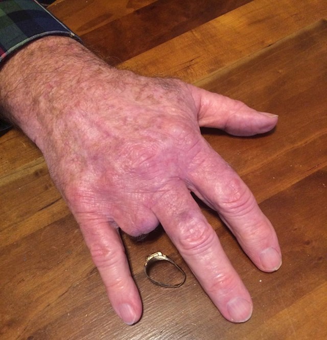 Djed je izgubio prst u nesreći na poslu prije 50 godina. Danas je pronašao prsten