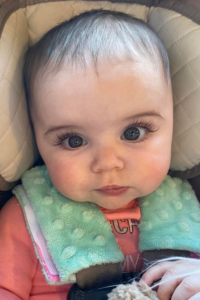 Rodila se s ovakvim trepavicama