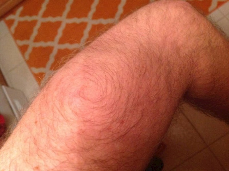 Dlake na nogama stvaraju krug