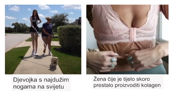12 ljudi s toliko rijetkim osobinama da se viđaju jednom u milijun slučajeva