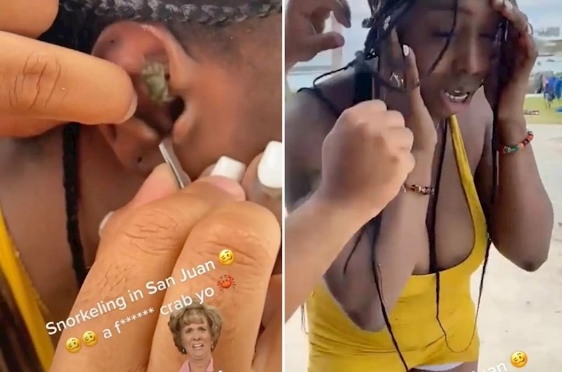 Srećom, u blizini se našao doktor koji je imao liječničke škare