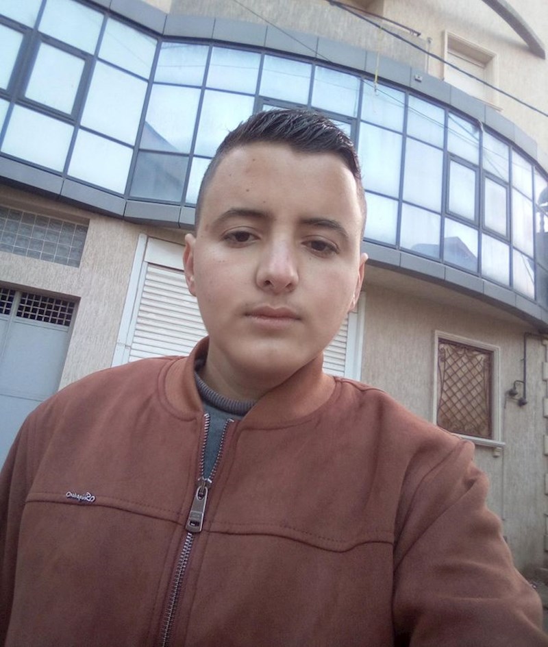 Imam 26 godina i nula dlaka na licu