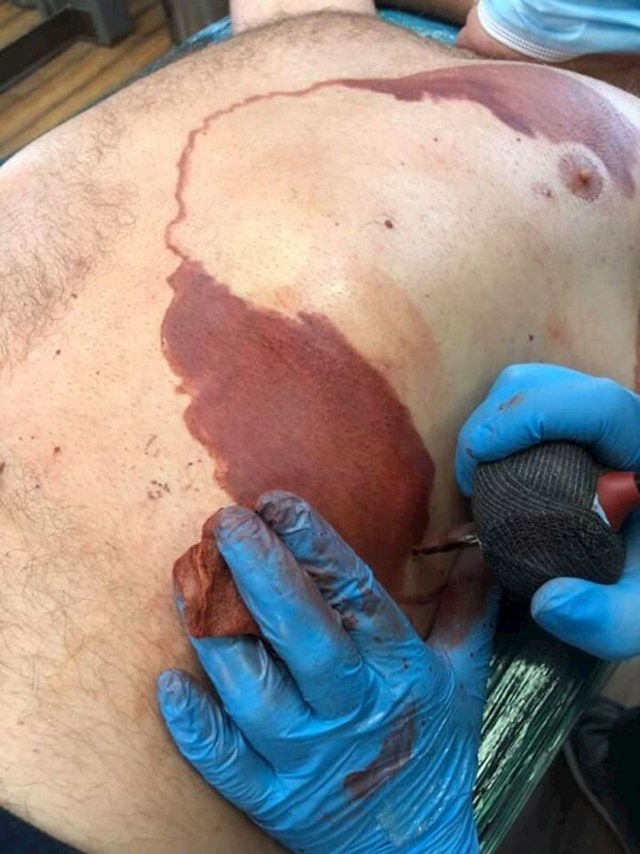 Tata je izdržao čak 30 sati priličnih bolova kako bi si tetovirao identičan biljeg kao kod svog sina
