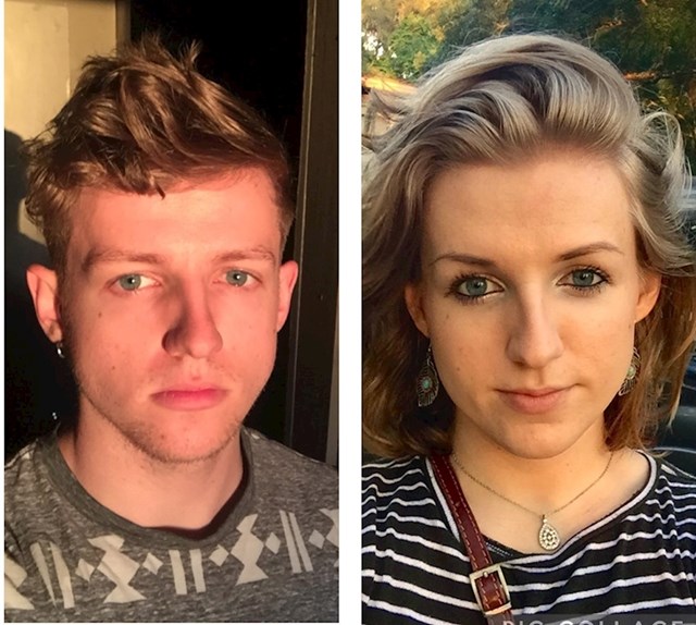 Prije i poslije procesa promjene spola