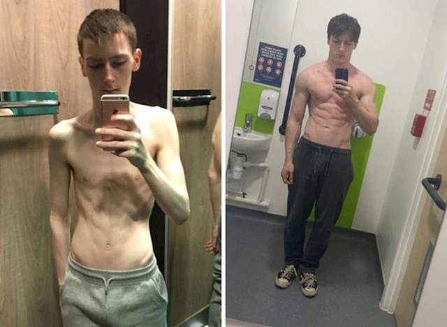 Dvije godine nakon što je sebi priznao da ima anoreksiju