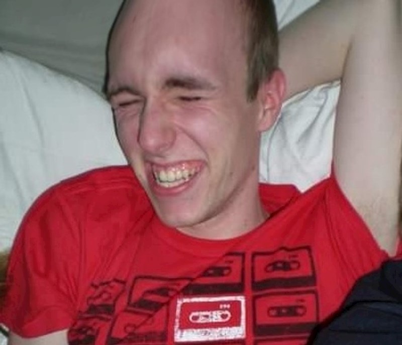 Ja, sa 16, do osamnaeste sam kompletno oćelavio