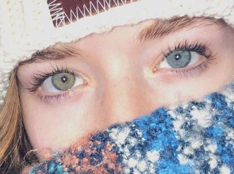 Ima oči različitih boja