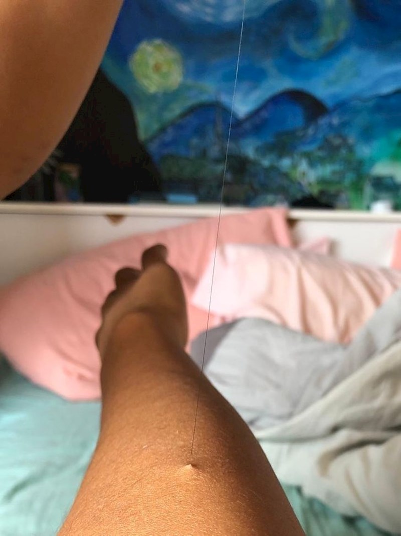 Probudio sam se s ogromnom dlakom na ruci