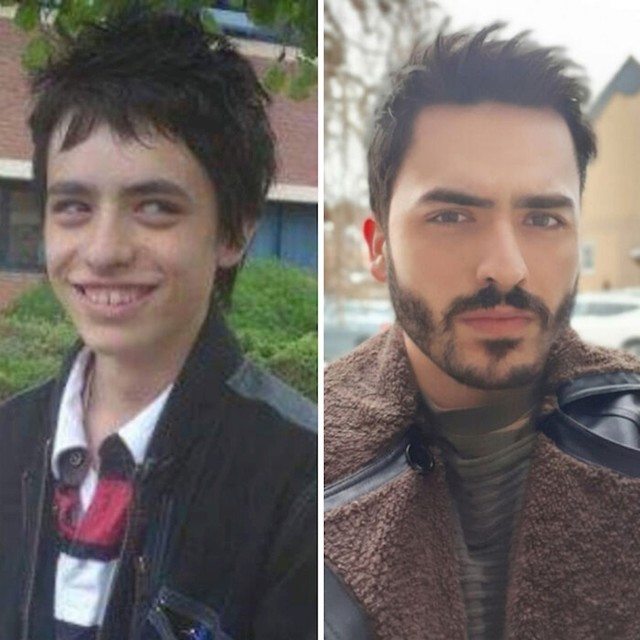 17 vs 27