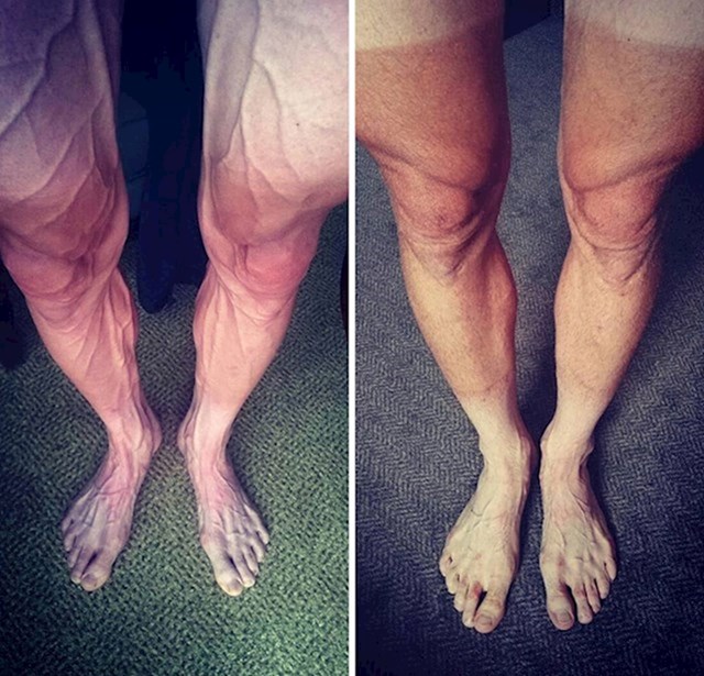 Noge biciklista nakon olimpijske utrke u usporedbi s nogama nakon rekreativne vožnje