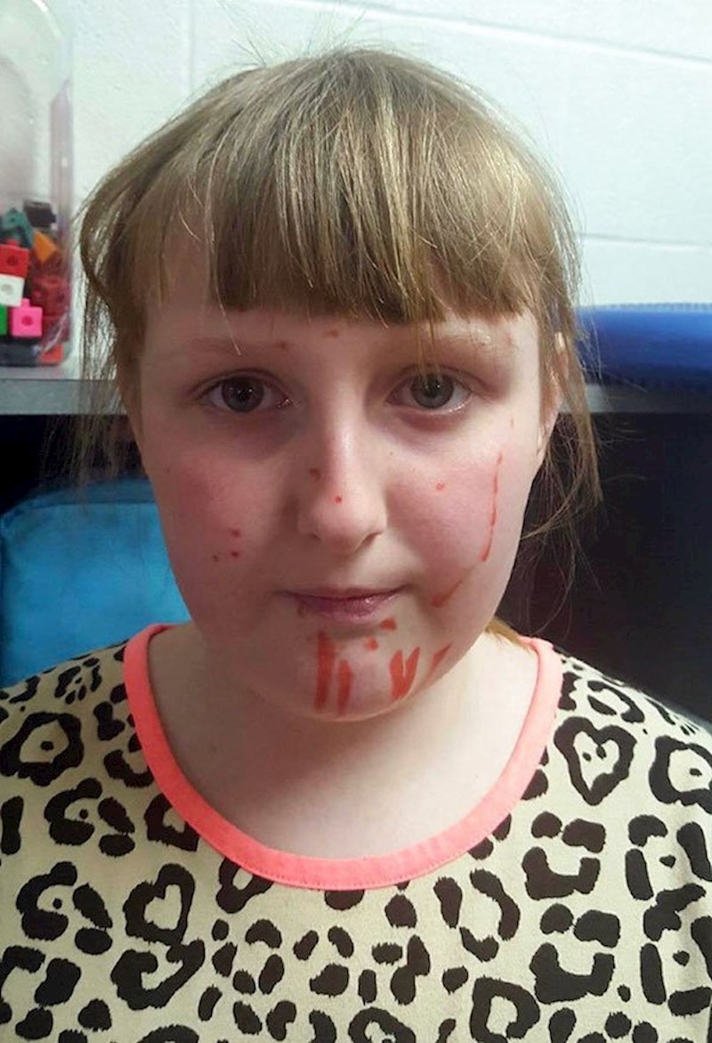 Nije htjela ići u školu pa je flomasterom nacrtala vodene kozice po licu