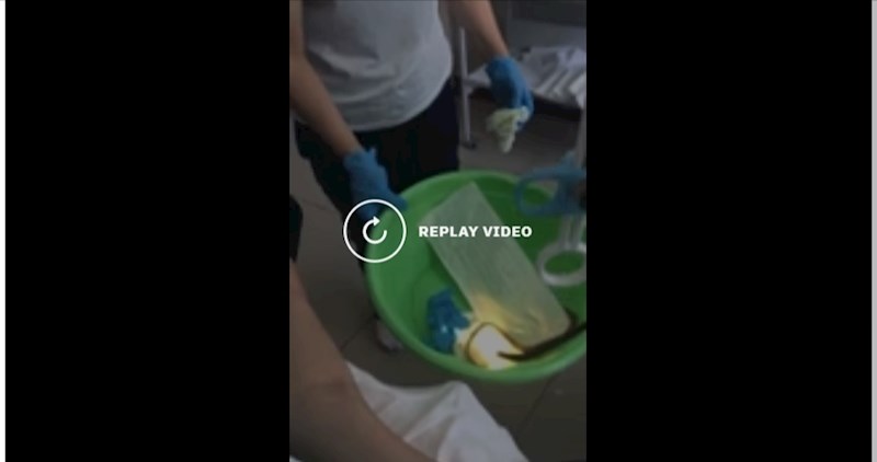 VIDEO Jeste se ikad pitali kako izgleda vađenje trakavice kroz usta?