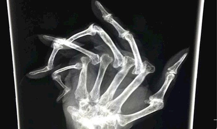 Najčudnije rendgenske snimke koje ste ikad vidjeli
