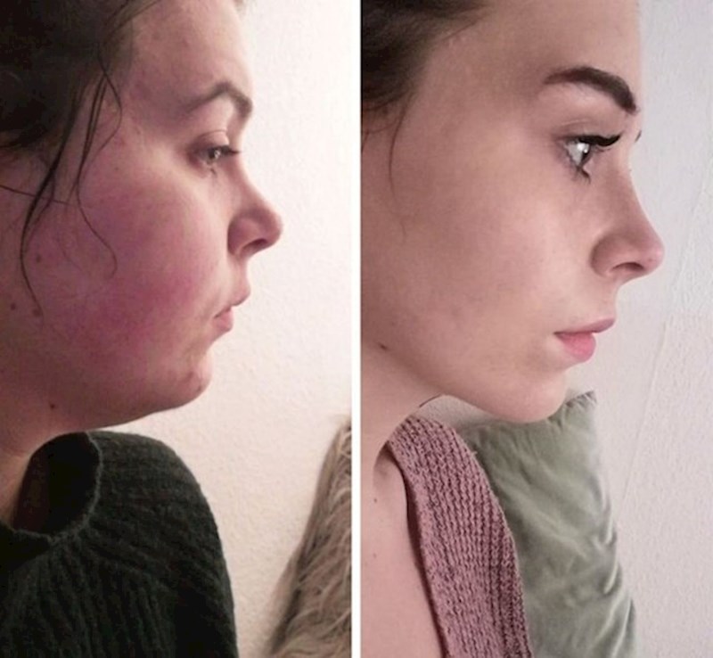 "Botoks, zubni aparatić, estetski zahvat... Ne, samo sam skinula 20 kg!"