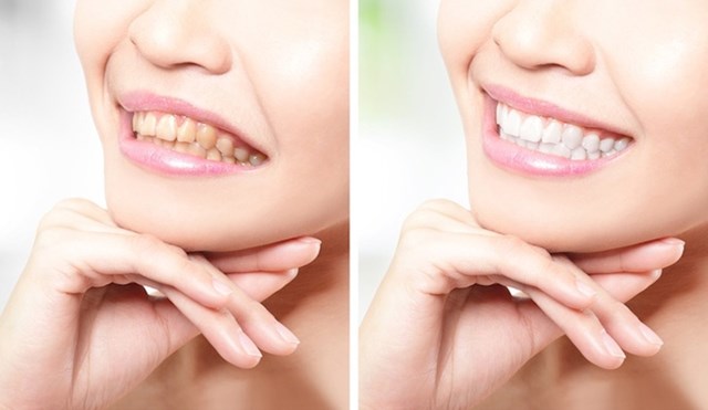 Ljudi više mare za izgled i zdravlje zubi