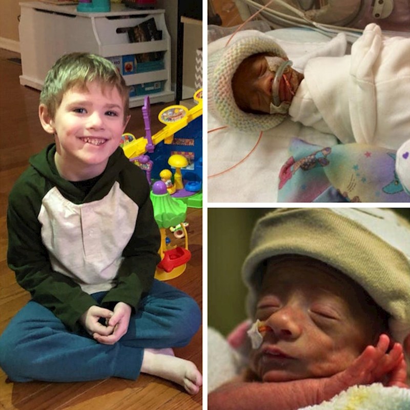 Rodio se u 29. tjednu i mislili su da neće preživjeti, ovo je on danas