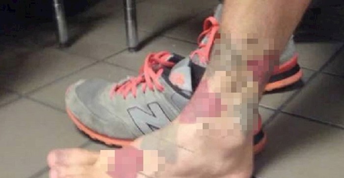 Ovaj lik se dosjetio što učiniti kada trebaš čarape, a sve su ti na pranju