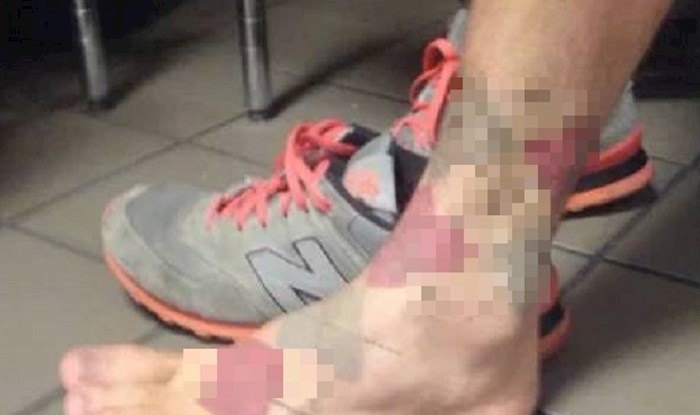 Ovaj lik se dosjetio što učiniti kada trebaš čarape, a sve su ti na pranju