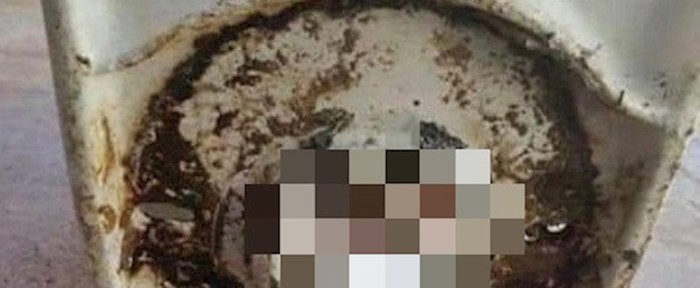 Djedu je upala proteza u wc školjku, ovo je jeziva posljedica