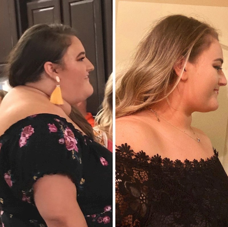 "Napokon imam vrat! Skinula sam 100 kilograma!"