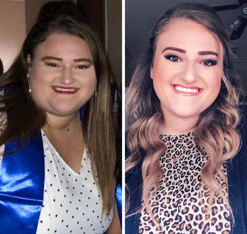 "Napokon više nemam podbradak! :D"