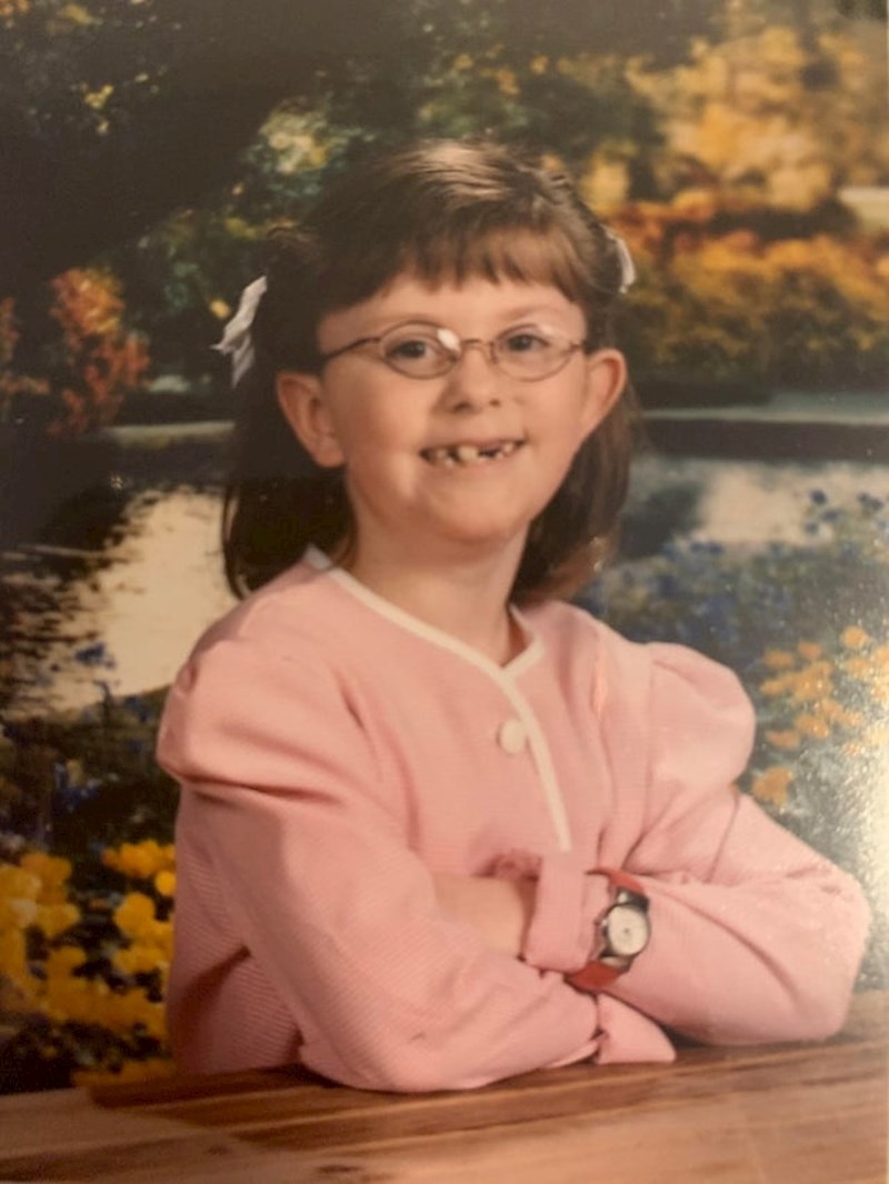 "Život nije lak kada sa 7 godina izgledate kao šalteruša bez zubi..."