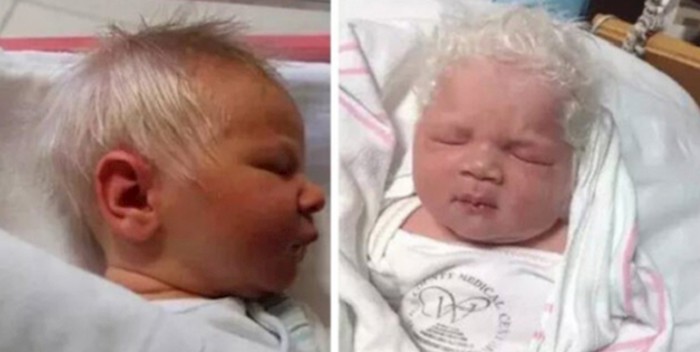 VIDEO Ova beba je rođena sa sijedom kosom, pogledajte kako je to moguće