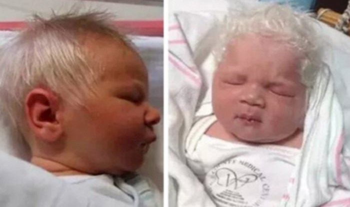 VIDEO Ova beba je rođena sa sijedom kosom, pogledajte kako je to moguće