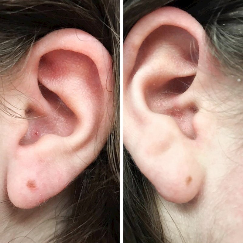 "Moj frend ima prirodne naušnice"