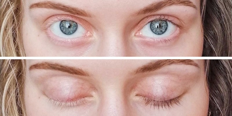 "Trepavice su mi različite boje"