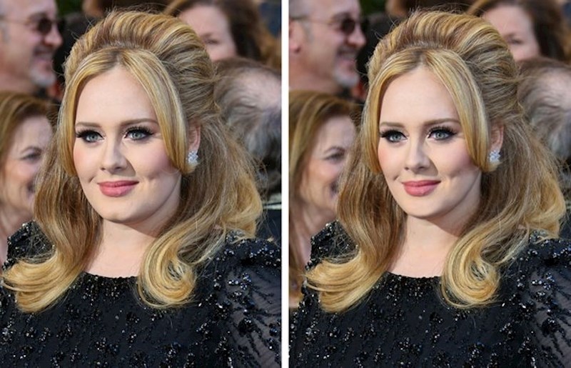 Adele i njena rupica na bradi