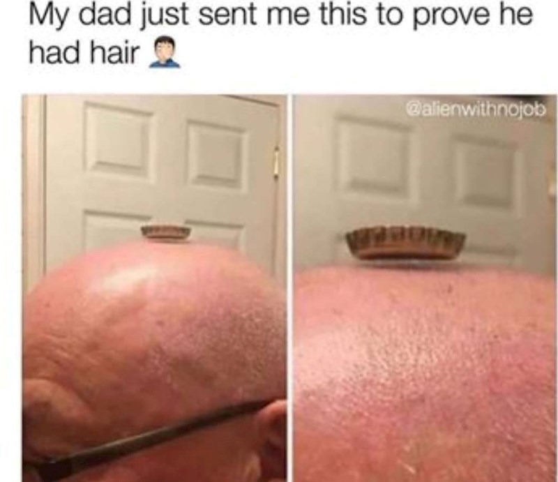 "Tata mi je poslao ovu fotku kako bi mi dokazao da još ima kose"