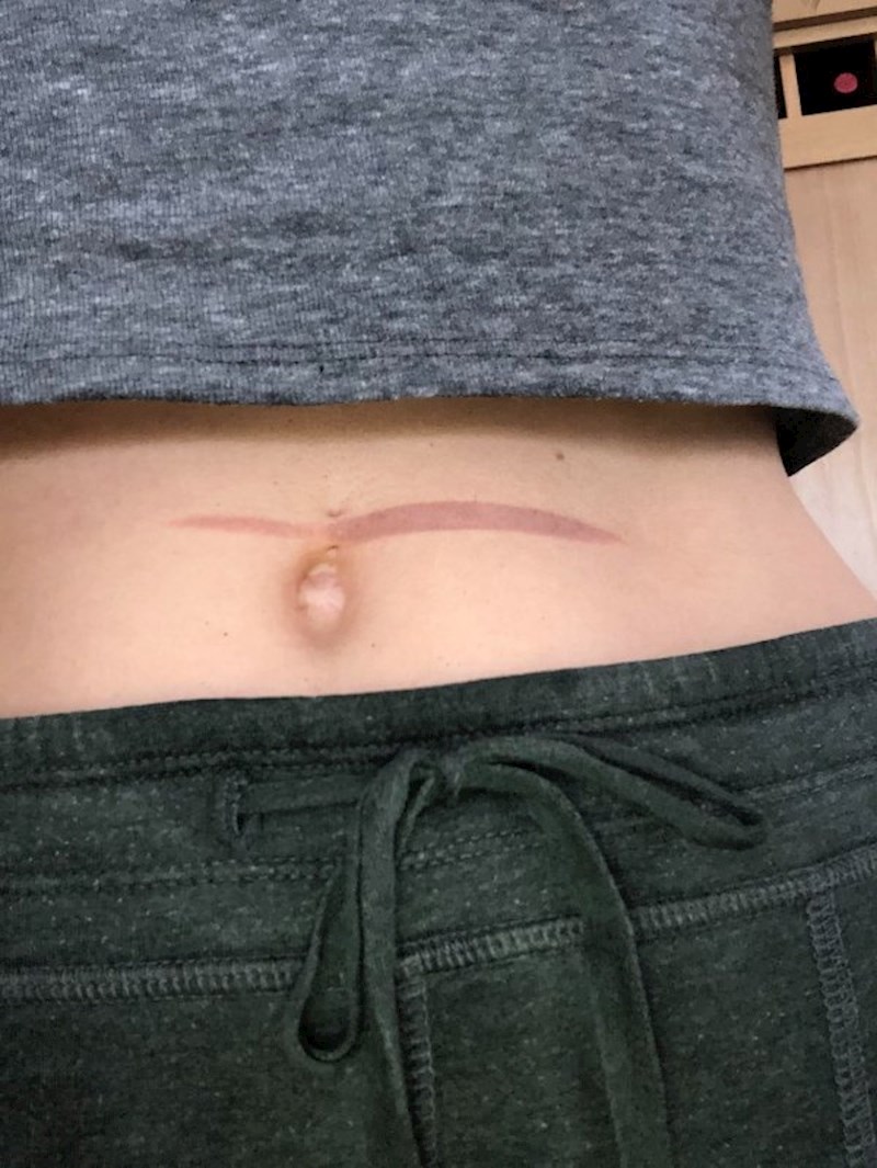 "Ne radite kolače u pećnici s golim trbuhom"