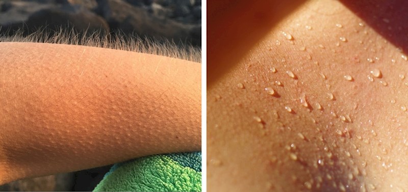 Ježenje je znak iznenadne promjene emocija