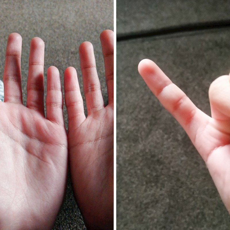 "Pogledajte moj prst!"