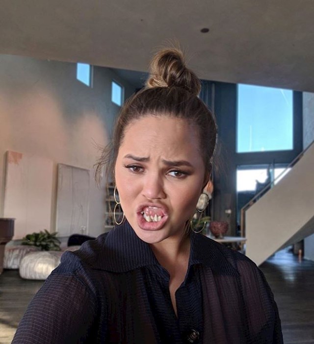 Chrissy Teigen