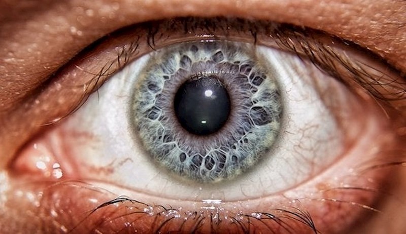 Neobična šarenica oka