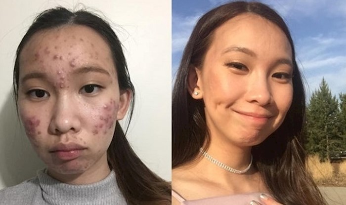 12 nevjerojatnih transformacija koje nam najbolje pokazuju prolaznost vremena
