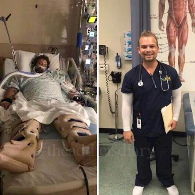 Ljudi su prošli pakao droge, ovo su njihove šokantne preobrazbe