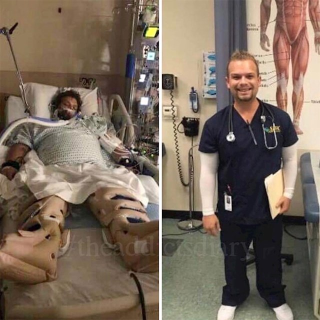 Ljudi su prošli pakao droge, ovo su njihove šokantne preobrazbe