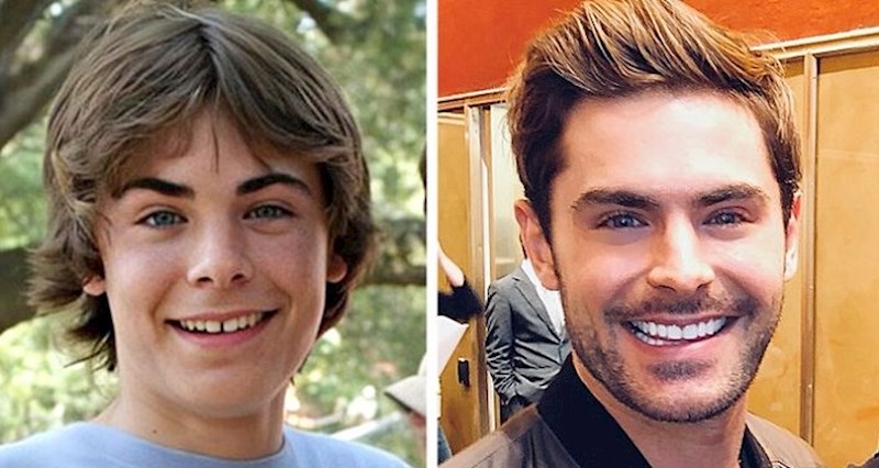 Pogledajte kakve su zube imale ove poznate osobe na početku karijere